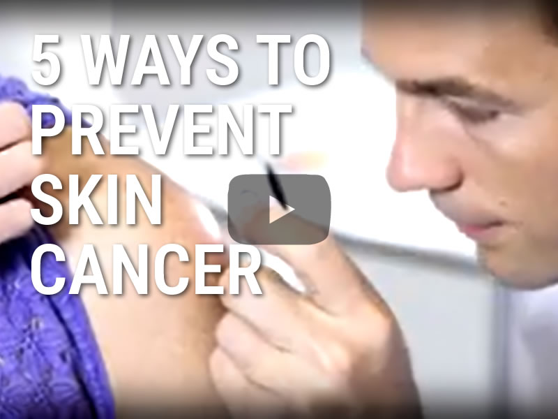 Video: 5 Ways to Prevent Skin Cancer